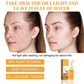 💋Big Sale 50% OFF💋Turmeric Facial Foam Cleanser